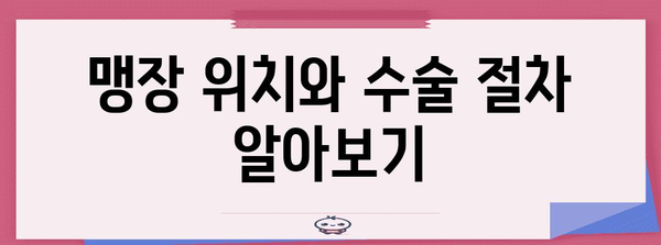 맹장수술 | 위치, 절차, 회복 기간