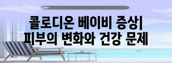 콜로디온 베이비 | 원인, 증상, 치료 옵션